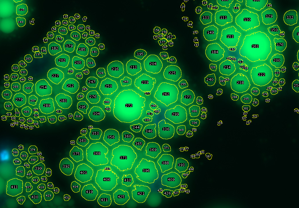 result image of lipid droplets tool